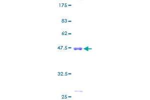 Image no. 1 for Prostaglandin D2 Synthase (PTGDS) (AA 1-190) protein (GST tag) (ABIN1316723) (PTGDS Protein (AA 1-190) (GST tag))