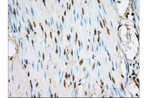 Immunohistochemical staining of paraffin-embedded liver tissue using anti-ACSBG1 mouse monoclonal antibody. (ACSBG1 antibody)