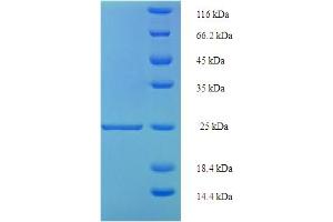 SDS-PAGE (SDS) image for Resistin (RETN) (AA 19-108) protein (His-SUMO Tag) (ABIN5710248) (Resistin Protein (RETN) (AA 19-108) (His-SUMO Tag))
