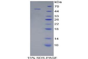 SDS-PAGE analysis of Rat Collagen Type XVIII Protein. (COL18 Protein)