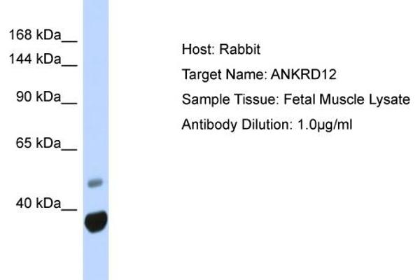 ANKRD12 antibody  (N-Term)