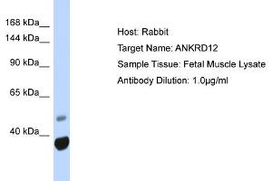 Host: Rabbit Target Name: ANKRD12 Sample Type: Fetal Muscle lysates Antibody Dilution: 1. (ANKRD12 antibody  (N-Term))