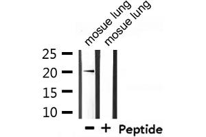 Western blot analysis of extracts from mosue lung, using Mammaglobin Antibody. (Mammaglobin A antibody  (Internal Region))