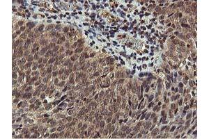 Image no. 1 for anti-V-Akt Murine Thymoma Viral Oncogene Homolog 1 (AKT1) antibody (ABIN1496555)