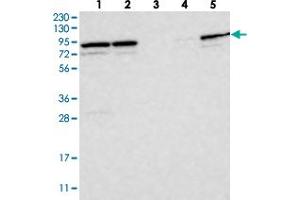 Western blot analysis of Lane 1: RT-4, Lane 2: U-251 MG, Lane 3: Human Plasma, Lane 4: Liver, Lane 5: Tonsil with PARP6 polyclonal antibody  at 1:250-1:500 dilution. (PARP6 antibody)