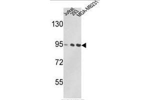 Western blot analysis of VCP Antibody (C-term) in Jurkat, 293, MDA-MB231 cell line lysates (35ug/lane). (VCP antibody  (C-Term))