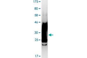 Image no. 2 for Tumor Necrosis Factor (Ligand) Superfamily, Member 8 (TNFSF8) (AA 63-234) protein (His-DYKDDDDK-Strep II Tag) (ABIN1323248)