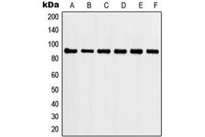 Western blot analysis of HSP90 alpha expression in MCF7 (A), HeLa (B), NIH3T3 (C), C6 (D), mouse liver (E), rat liver (F) whole cell lysates. (HSP90AA2 antibody  (C-Term))