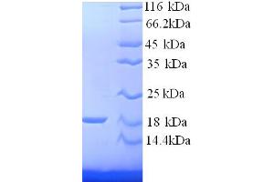 Hemoglobin, beta Adult Minor Chain (HBB-B2) (AA 2-147) protein (His tag)