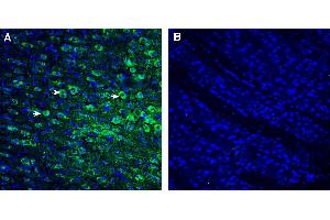 Expression of P2Y10 in mouse striatum.