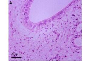 Haematoxylin and eosin and CD177 IHC staining in AS-affected and -unaffected oviduct tissues. (CD177 antibody  (AA 521-650))