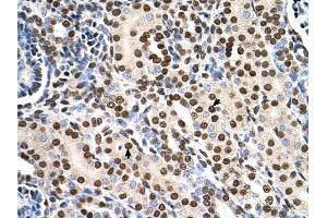 RSU1 antibody was used for immunohistochemistry at a concentration of 4-8 ug/ml to stain Epithelial cells of renal tubule (arrows) in Human Kidney. (RSU1 antibody  (C-Term))