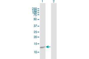 Western Blot analysis of CREBL2 expression in transfected 293T cell line by CREBL2 MaxPab polyclonal antibody. (CREBL2 antibody  (AA 1-120))