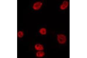 ABIN6275799 staining HepG2 by IF/ICC. (RFC2 antibody  (Internal Region))