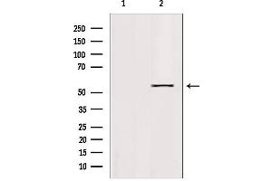 Western blot analysis of extracts from 293, using KLF11 Antibody.