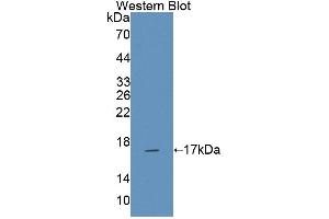Figure. (NCR3 antibody  (AA 21-147))