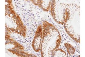 IHC-P Image Immunohistochemical analysis of paraffin-embedded human gastric , using MVP/LRP, antibody at 1:100 dilution. (MVP antibody  (C-Term))