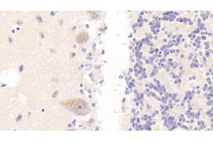 Detection of PLB in Human Cerebellum Tissue using Polyclonal Antibody to Phospholipase B (PLB) (Phospholipase B antibody  (AA 1036-1458))