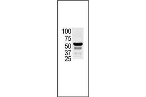 The anti-K2 b (ABIN392433 and ABIN2842033) is used in Western blot to detect K2 in ovary cell lysate. (PAK2 antibody  (N-Term))