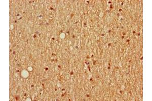 Immunohistochemistry of paraffin-embedded human brain tissue using ABIN7168669 at dilution of 1:100 (SCGN antibody  (AA 1-276))