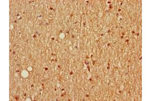 Immunohistochemistry of paraffin-embedded human brain tissue using ABIN7168669 at dilution of 1:100 (SCGN antibody  (AA 1-276))