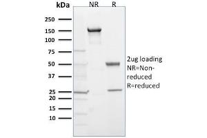SDS-PAGE Analysis Purified EGLN1 / PHD2 Mouse Monoclonal Antibody (366G/76/3). (EGLN1 antibody  (AA 1-24))