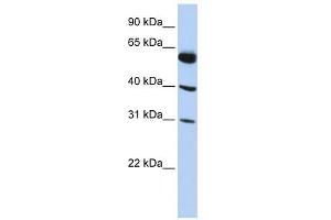 LYSMD4 antibody used at 1 ug/ml to detect target protein.