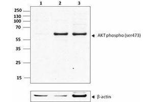 Western Blotting (WB) image for anti-V-Akt Murine Thymoma Viral Oncogene Homolog 1 (AKT1) (phosphorylated) antibody (ABIN2666092) (AKT1 antibody  (phosphorylated))