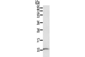 Western Blotting (WB) image for anti-S100 Calcium Binding Protein P (S100P) antibody (ABIN5544743) (S100P antibody)