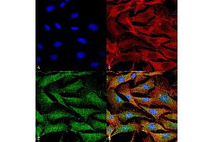 Immunocytochemistry/Immunofluorescence analysis using Mouse Anti-Copper Transporting ATPase 1 Monoclonal Antibody, Clone S60-4 . (ATP7A antibody  (AA 42-61) (PE))