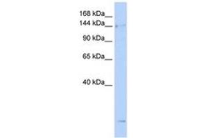 Image no. 1 for anti-Structural Maintenance of Chromosomes 4 (SMC4) (AA 36-85) antibody (ABIN6743408) (SMC4 antibody  (AA 36-85))