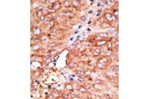 Image no. 2 for anti-Chemokine Binding Protein 2 (CCBP2) (C-Term) antibody (ABIN357386) (CCBP2 antibody  (C-Term))