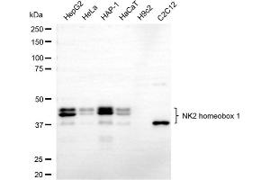 Western blotting analysis using NK2 homeobox 1 antibody (ABIN7799607). (Recombinant NKX2-1 antibody)