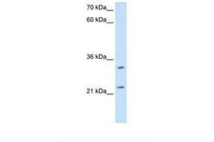 Image no. 2 for anti-Chromosome 21 Open Reading Frame 33 (C21orf33) (AA 71-120) antibody (ABIN320994) (C21orf33 antibody  (AA 71-120))