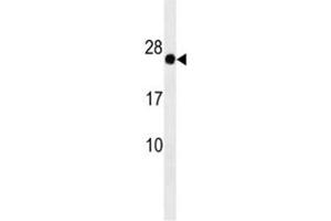 GAGE12F antibody western blot analysis in HepG2 lysate (G Antigen 12F antibody  (AA 1-30))