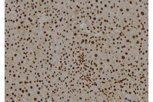 ABIN6265182 and ABIN6277544 at 1/100 staining Mouse liver tissue by IHC-P.