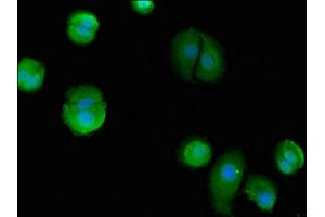 Immunofluorescent analysis of MCF-7 cells using ABIN7145218 at dilution of 1:100 and Alexa Fluor 488-congugated AffiniPure Goat Anti-Rabbit IgG(H+L) (BAG4 antibody  (AA 6-185))