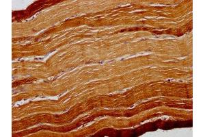 IHC image of ABIN7168596 diluted at 1:300 and staining in paraffin-embedded human skeletal muscle tissue performed on a Leica BondTM system. (ATP2A1/SERCA1 antibody  (AA 384-579))
