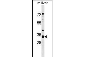Western Blotting (WB) image for anti-Anterior Pharynx Defective 1 Homolog A (C. Elegans) (APH1A) (AA 41-70), (N-Term) antibody (ABIN1539365)