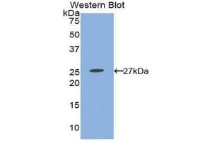 Western Blotting (WB) image for anti-Prostaglandin E Receptor 2 (Subtype EP2), 53kDa (PTGER2) (AA 155-355) antibody (ABIN3208970) (PTGER2 antibody  (AA 155-355))
