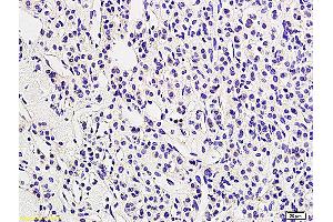 Formalin-fixed and paraffin embedded human adrenal tissue labeled with Anti LHR/CGR Polyclonal Antibody, Unconjugated (ABIN873328) followed by conjugation to the secondary antibody and DAB staining (LHCGR antibody  (AA 201-300))