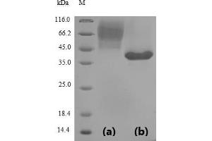 (Tris-Glycine gel) Discontinuous SDS-PAGE (reduced) with 5 % enrichment gel and 15 % separation gel. (SARS-CoV-2 Spike S1 Protein (RBD) (His-SUMOstar Tag))