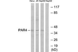 Western Blotting (WB) image for anti-Coagulation Factor II (Thrombin) Receptor-Like 3 (F2RL3) (AA 29-78) antibody (ABIN2891147) (F2RL3 antibody  (AA 29-78))