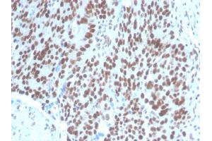 Immunohistochemistry (IHC) image for anti-Paired Box Gene 2a (PAX2A) (AA 223-354) antibody (ABIN6940252)