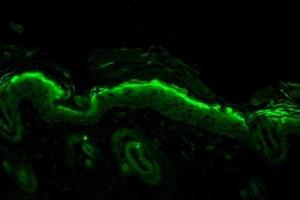 Immunohistochemistry analysis using Mouse Anti-Nitrotyrosine Monoclonal Antibody, Clone 39B6 . (Nitrotyrosine antibody  (Atto 488))