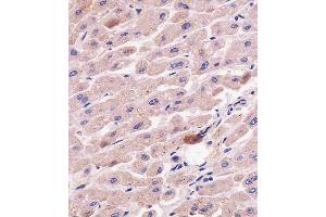 C staining G7L in human liver tissue sections by Immunohistochemistry (IHC-P - paraformaldehyde-fixed, paraffin-embedded sections). (ATG7 antibody  (AA 494-523))