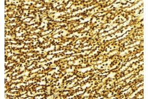 ABIN6269389 at 1/100 staining Human gastric tissue by IHC-P. (SIRT1 antibody  (N-Term))