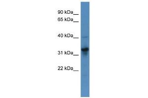 WB Suggested Anti-T Antibody Titration:  0. (T Brachyury Protein (N-Term) antibody)