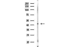anti-Olfactomedin-Like 1 (OLFML1) antibody