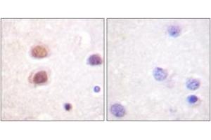 Immunohistochemistry analysis of paraffin-embedded human brain, using p38 MAPK (Phospho-Tyr322) Antibody. (MAPK14 antibody  (pTyr322))